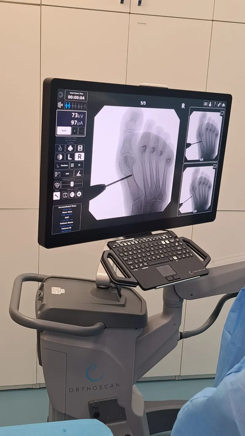 Všeobecná ortopedie